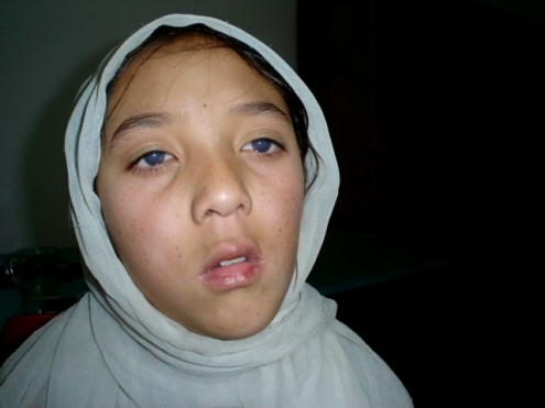 Nevidiaci v Afganistane